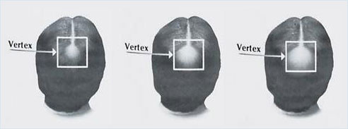 vertex